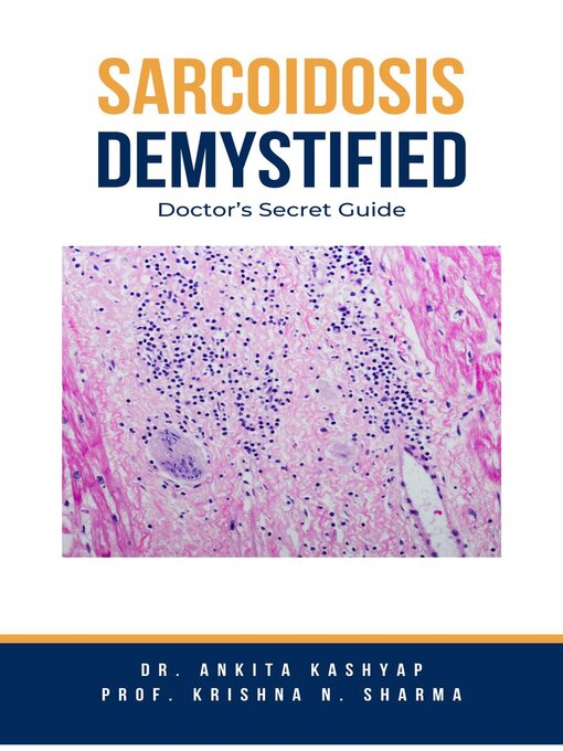 Title details for Sarcoidosis Demystified by Dr. Ankita Kashyap - Available